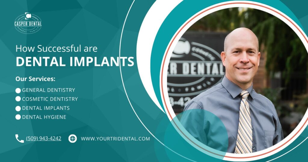 dental implants by Casper Dental